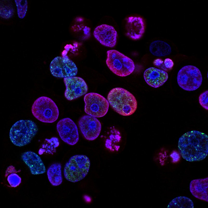 Elastin: The Protein Behind Skin Bounce and Its Age-Related Changes